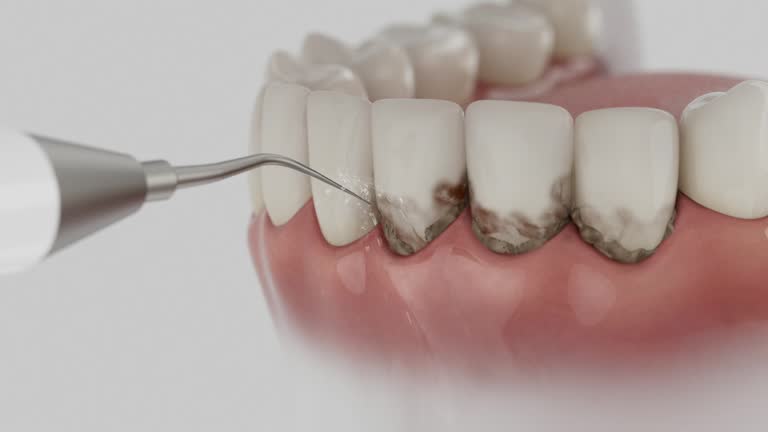 Reliable Dental contractor in Crooked Lake Park, FL by Dentist Open Now